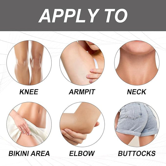 Dark Spot Remover Cream (30ml)