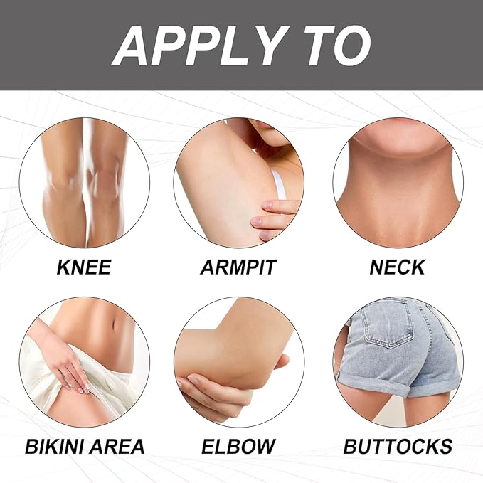 Dark Spot Remover Cream (30ml)