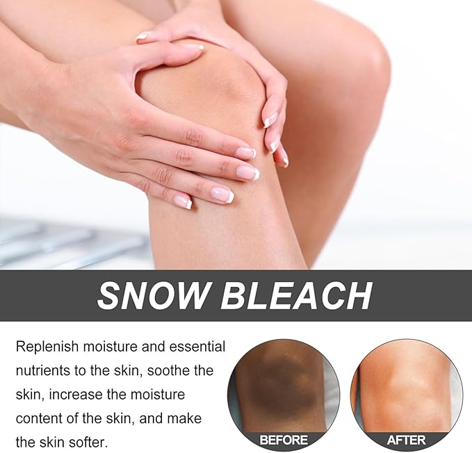 Dark Spot Remover Cream (30ml)